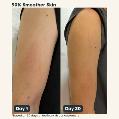 SnowSkin™ Body Wash - Brighter, Glowing Skin With 1 Minute A Day