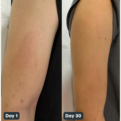 SnowSkin™ Body Wash - Brighter, Glowing Skin With 1 Minute A Day (Subscription)